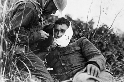 After WW1
